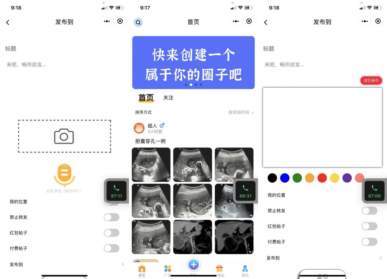 简洁漂亮 社区论坛小程序源码 功能齐全 前端+后端插图3