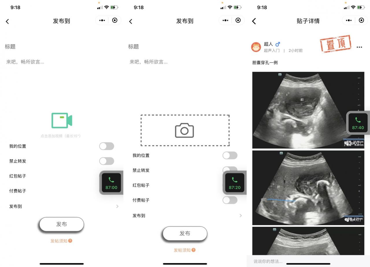 简洁漂亮 社区论坛小程序源码 功能齐全 前端+后端插图2